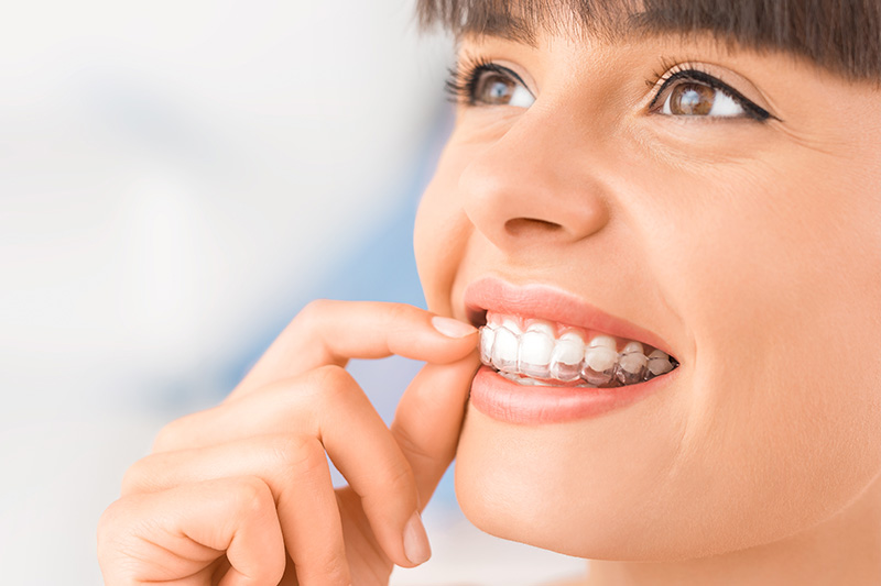 Invisalign Dentist in North Seattle