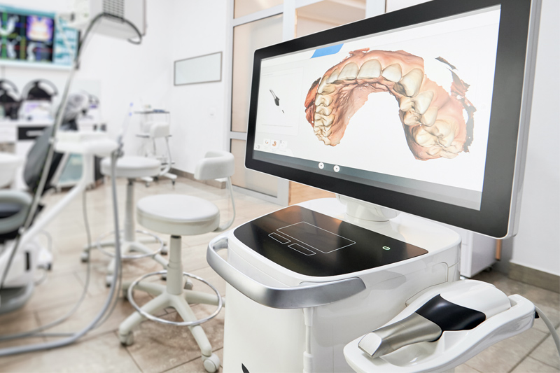 Intra-Oral Scanners in North Seattle